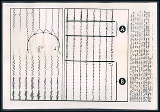 Einstein, Albert. (1879 - 1955) Photograph of Einstein's Brain Waves!
