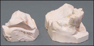 Michener, James. (1907 - 1997) Medical Dental Oddity: Models of Pulitzer Author James A Michener's Teeth [Right Posterior Quadrant]