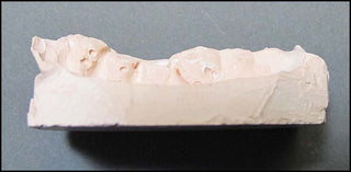 Michener, James. (1907 - 1997) Medical Dental Oddity: Models of Pulitzer Author James A Michener's Teeth [Right Posterior Quadrant]