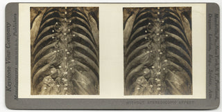 [Science] Anatomical Stereoscope Card Collection