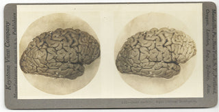 [Science] Anatomical Stereoscope Card Collection