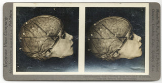 [Science] Anatomical Stereoscope Card Collection