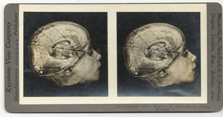 [Science] Anatomical Stereoscope Card Collection