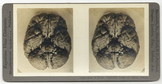 [Science] Anatomical Stereoscope Card Collection