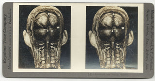 [Science] Anatomical Stereoscope Card Collection