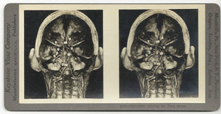 [Science] Anatomical Stereoscope Card Collection