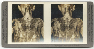 [Science] Anatomical Stereoscope Card Collection