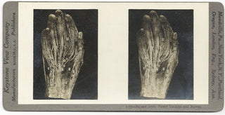 [Science] Anatomical Stereoscope Card Collection