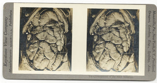 [Science] Anatomical Stereoscope Card Collection