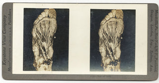 [Science] Anatomical Stereoscope Card Collection